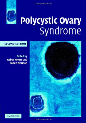 Polycystic Ovary Syndrome 2nd Edition 2nd Edition Gabor T Kovacs