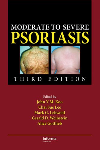 Moderatetosevere Psoriasis Third Edition 3rd Edition John Ym Koo