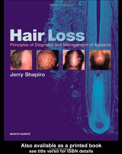 Hair Loss Principles Of Diagnosis And Management Of Alopecia 1st Edition Jerry Shapiro