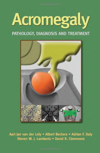 Acromegaly Pathology Diagnosis And Treatment 1st Edition Aart Jan Van Der Lely
