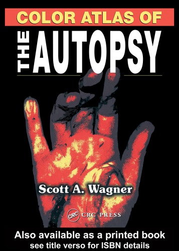 Color Atlas Of The Autopsy Scott A Wagner