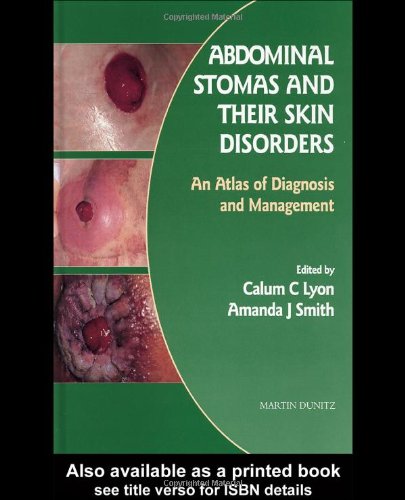 Abdominal Stomas And Their Skin Disorders An Atlas Of Diagnosis And Management 1st Edition Calum C Lyon