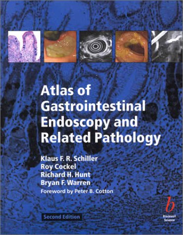 Atlas Of Gastrointestinal Endoscopy And Related Pathology 2nd Ed 2nd Edition Klaus F R Schiller