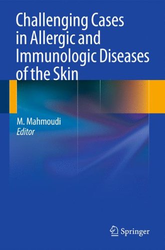 Challenging Cases In Allergic And Immunologic Diseases Of The Skin 1st Edition Lloyd J Cleaver