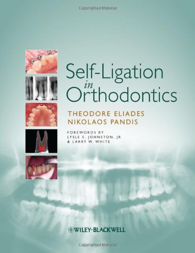 Selfligation In Orthodontics 1st Edition Theodore Eliades Nikolaos Pandis