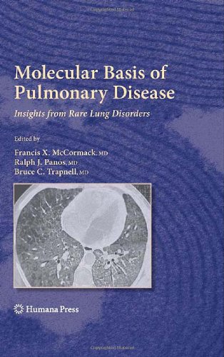 Molecular Basis Of Pulmonary Disease Insights From Rare Lung Disorders 1st Edition Ralph J Panos Md Auth