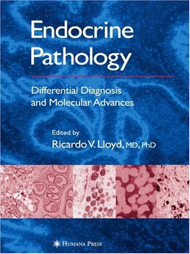 Endocrine Pathology Differential Diagnosis And Molecular Advances 1st Edition Ricardo V Lloyd