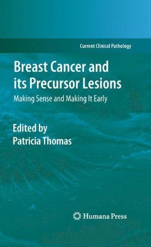 Breast Cancer And Its Precursor Lesions Making Sense And Making It Early 1st Edition Patricia A Thomas Auth