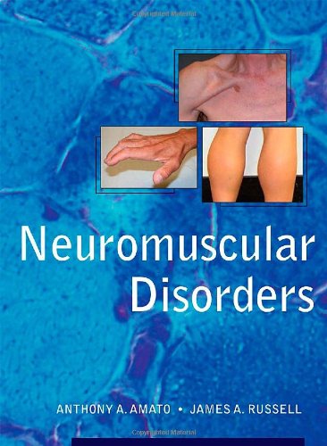 Neuromuscular Disorders 1st Edition Anthony Amato James A Russell
