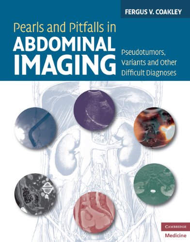 Pearls And Pitfalls In Abdominal Imaging Pseudotumors Variants And Other Difficult Diagnoses 1st Edition Fergus V Coakley Md