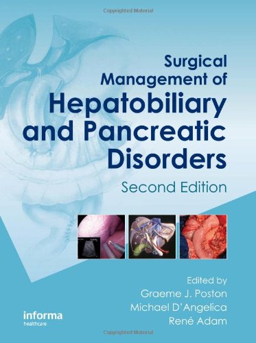 Surgical Management Of Hepatobiliary And Pancreatic Disorders Second Edition Oncologysurgery Graeme J Poston