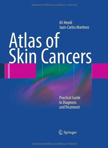 Atlas Of Skin Cancers Practical Guide To Diagnosis And Treatment 1st Edition Ali Hendi