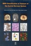 Who Classification Of Tumours Of The Central Nervous System Who Classfication Of Tumours Fourth Edition David N
