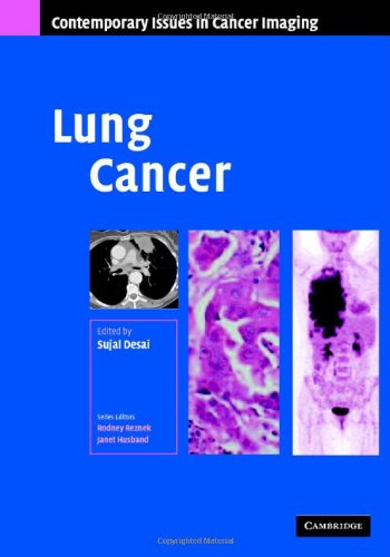 Lung Cancer Contemporary Issues In Cancer Imaging 1st Edition Sujal R Desai