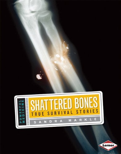 Shattered Bones True Survival Stories Powerful Medicine Sandra Markle