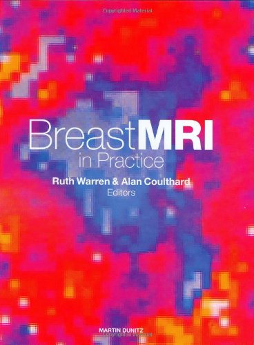 Breast Mri In Practice 1st Edition R Warren Alan Coulthard