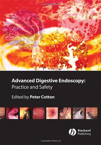 Advanced Digestive Endoscopy Practice And Safety 1st Edition Peter B Cotton