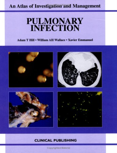 Pulmonary Infection An Atlas Of Investigation And Management 1st Edition Adam T Hill