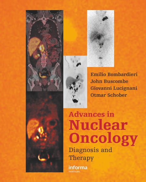 Advances In Nuclear Oncology Diagnosis And Therapy 1st Edition Emilio Bombardieri