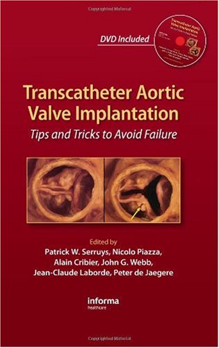 Transcatheter Aortic Valve Implantation Tips And Tricks To Avoid Failure 1 Harcdr Patrick W Serruys