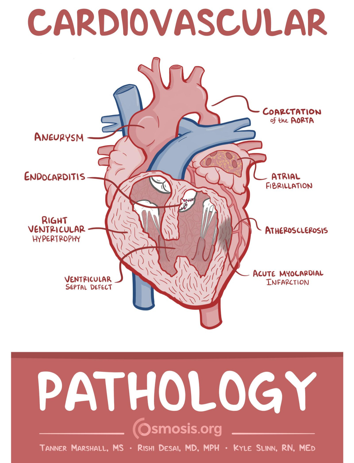 Cardiovascular Pathology Tanny Marshall Rishi Desai Kyle Slinn
