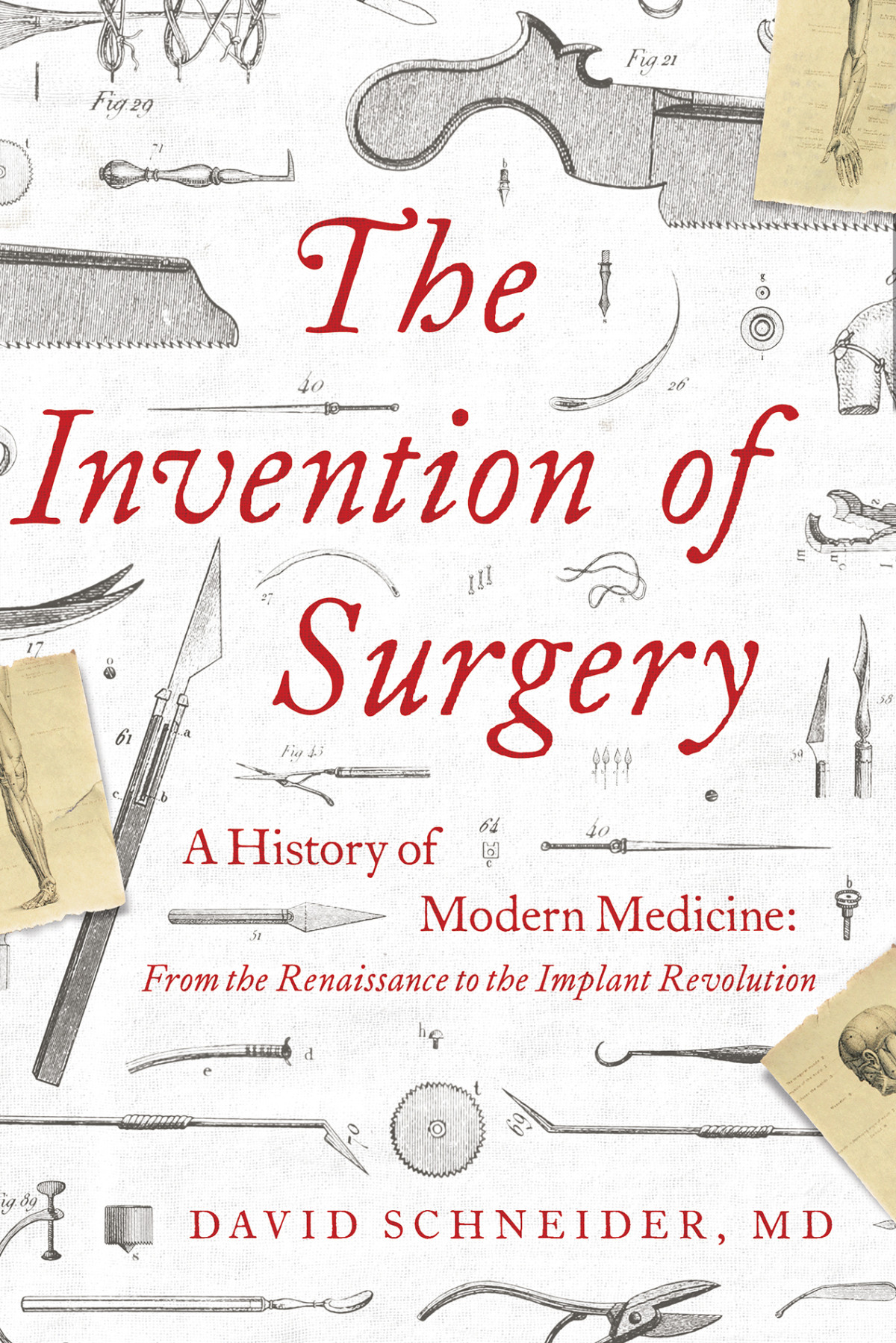 The Invention Of Surgery David Schneider