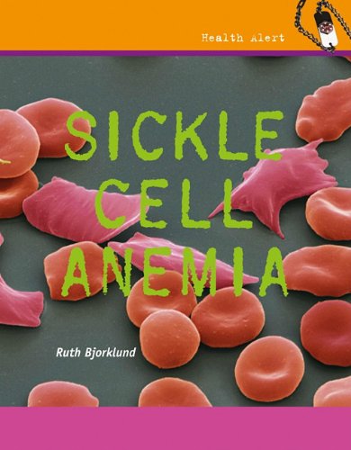Sickle Cell Anemia 1st Edition Ruth Bjorklund