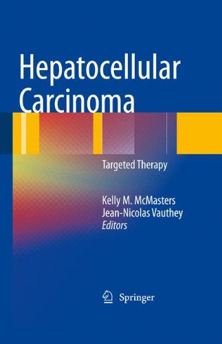Hepatocellular Carcinoma Targeted Therapy And Multidisciplinary Care 1st Edition Manal M Hassan