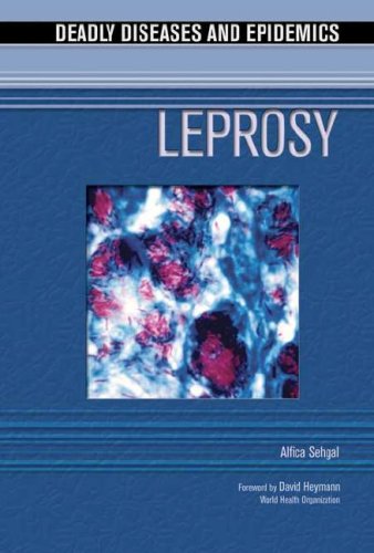 Leprosy Alfica Sehgal