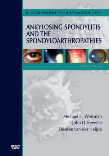 Ankylosing Spondylitis And The Spondyloarthropathies A Companion To Rheumatology 3e 1st Edition Michael H Weisman Md