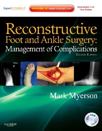 Reconstructive Foot And Ankle Surgery Management Of Complications Expert Consult Online Print Second Edition 2nd Edition Mark S Myerson Md