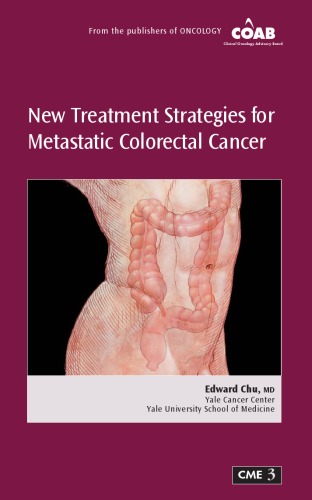 New Treatment Strategies For Metastatic Colorectal Cancer Edward Chu