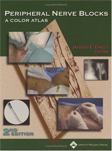 Peripheral Nerve Blocks A Color Atlas Second Jacques E Chelly