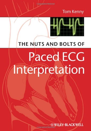 The Nuts And Bolts Of Paced Ecg Interpretation Nuts And Bolts Series 1st Edition Tom Kenny