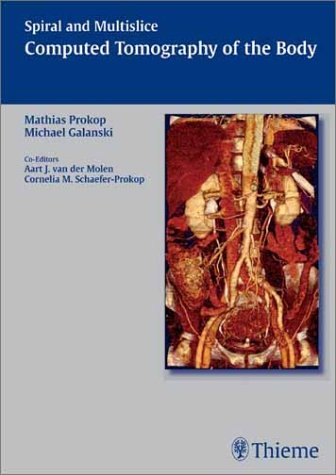 Spiral And Multislice Computed Tomography Of The Body Thieme 1st Edition Mathias Prokop