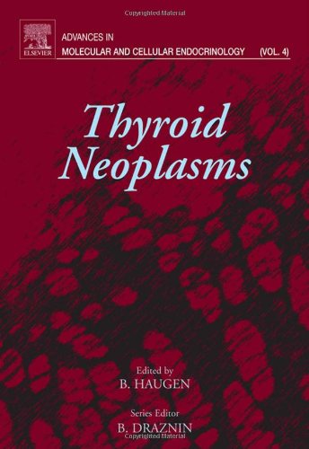 Thyroid Neoplasms 1st Edition Bryan Haugen Eds