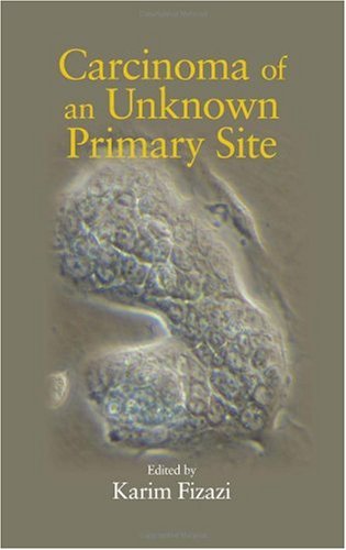 Carcinoma Of An Unknown Primary Site 1st Edition Karim Fizazi