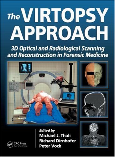The Virtopsy Approach 3d Optical And Radiological Scanning And Reconstruction In Forensic Medicine 1st Edition Michael J Thali