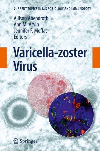 Varicellazoster Virus 1st Edition Jeffrey I Cohen Auth Allison Abendroth