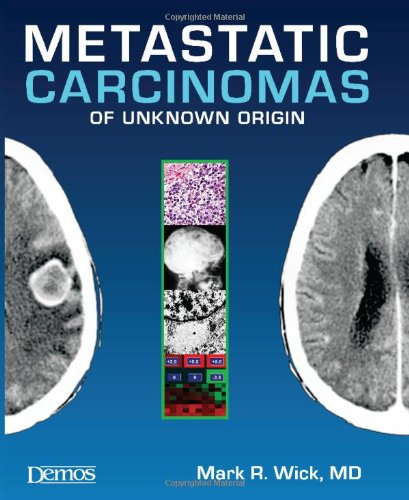 Metastatic Carcinomas Of Unknown Origin 1st Edition Mark R Wick