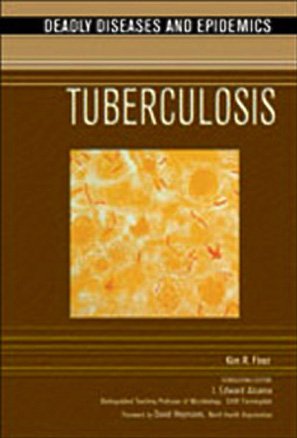 Tuberculosis Kim Renee Finer I Edward Alcamo