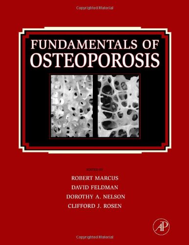Fundamentals Of Osteoporosis 1st Edition Robert Marcus David Feldman