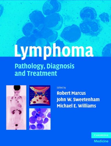 Lymphoma Pathology Diagnosis And Treatment 1st Edition Robert Marcus