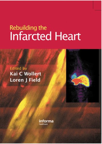 Rebuilding The Infarcted Heart 1st Edition Loren J Field Kai C Wollert