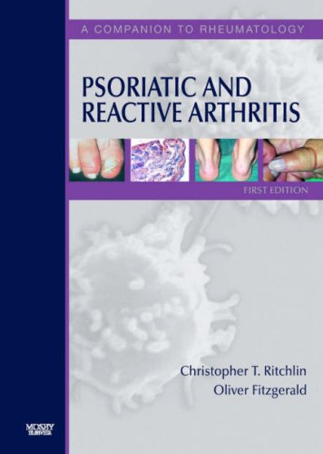 Psoriatic And Reactive Arthritis A Companion To Rheumatology 1st Edition Christopher Ritchlin Md