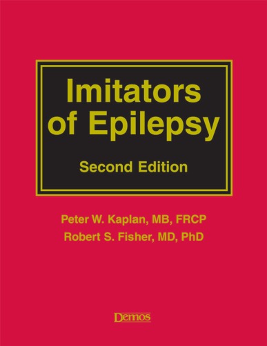 Imitators Of Epilepsy Second Edition Peter W Kaplan Robert S Fisher