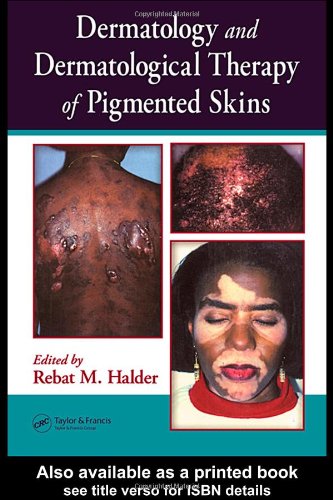 Dermatology And Dermatological Therapy Of Pigmented Skins 1st Edition Rebat Halder