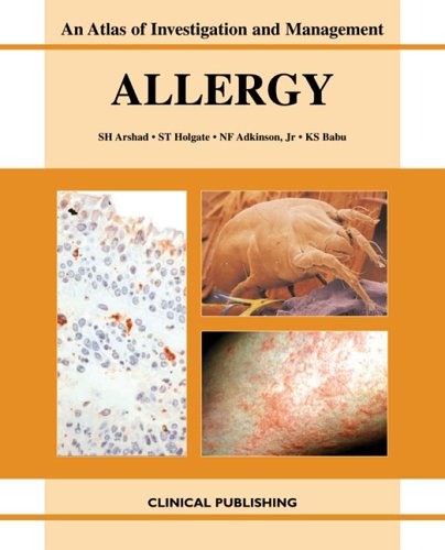 Allergy An Atlas Of Investigation And Management 2006 1st Edition Sh Arshad