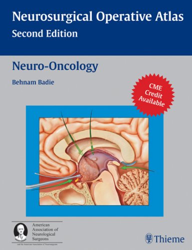 Neurooncology Neurosurgical Operative Atlas 2nd Edition 2nd Edition Behnam Badie