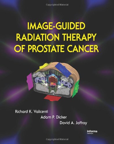 Imageguided Radiation Therapy Of Prostate Cancer 1st Edition K Valicenti Richard
